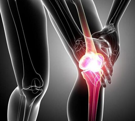 damage to the knee joint with arthritis and arthrosis