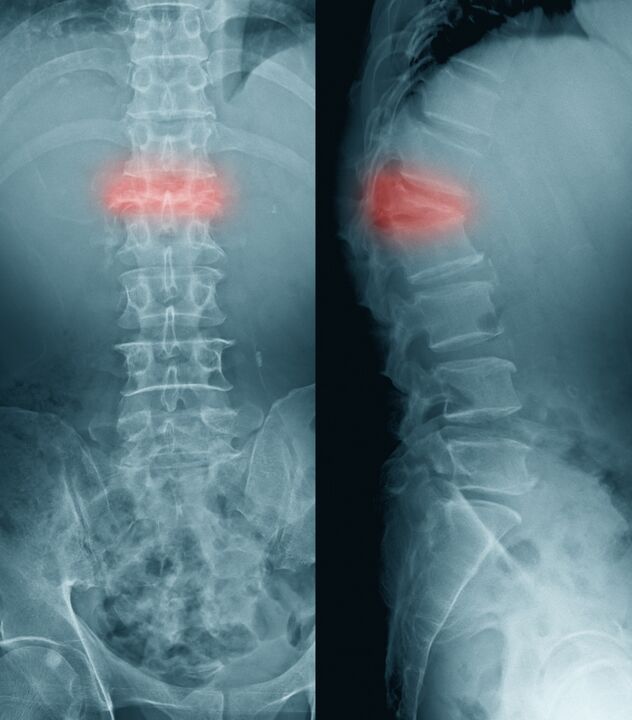 back pain diagnosis