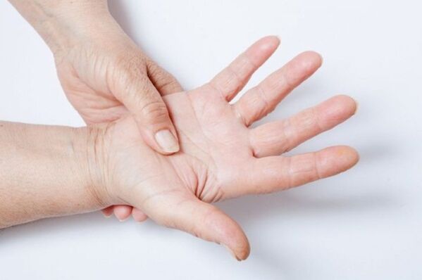 Hand numbness is one of the symptoms of lumbar osteochondrosis