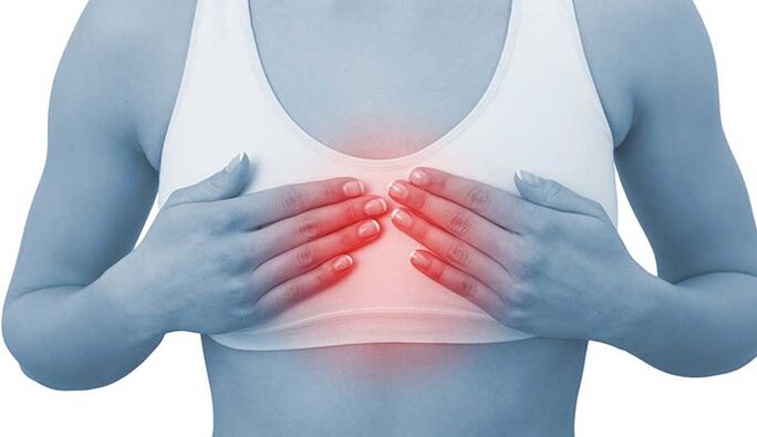 Pain for breast chondrosis can imitate heart pain