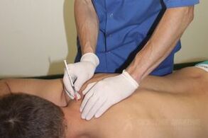 Passive treatment of osteochondrosis