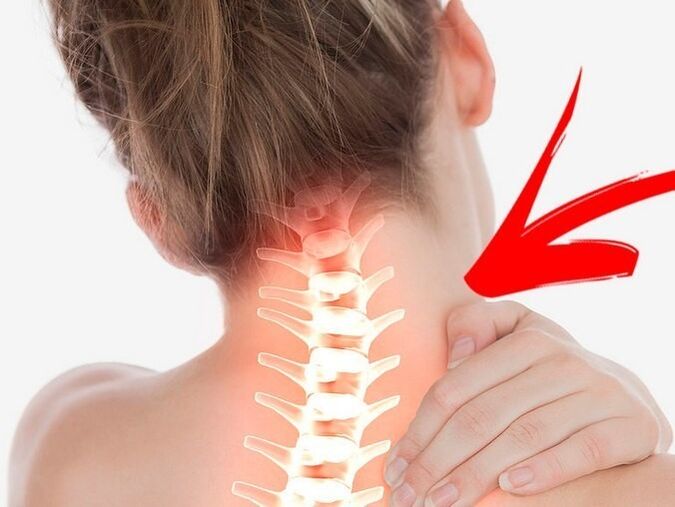Compression of nerve roots with cervical osteochondrosis