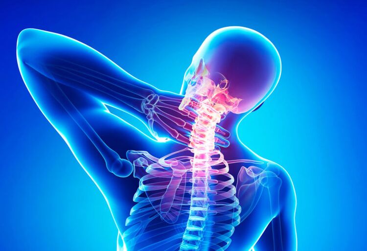 Osteochondrosis of the cervical spine