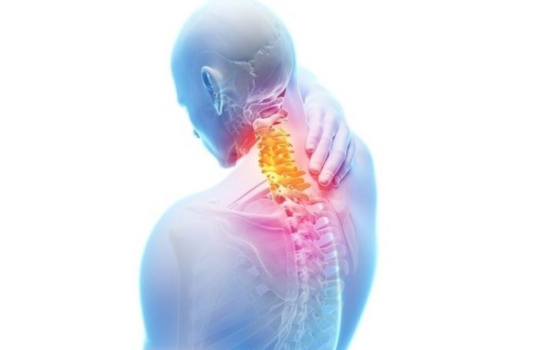 neck pain due to osteochondrosis