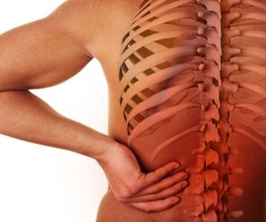 back pain with lumbar osteochondrosis
