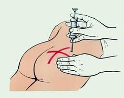 injection for the treatment of osteochondrosis