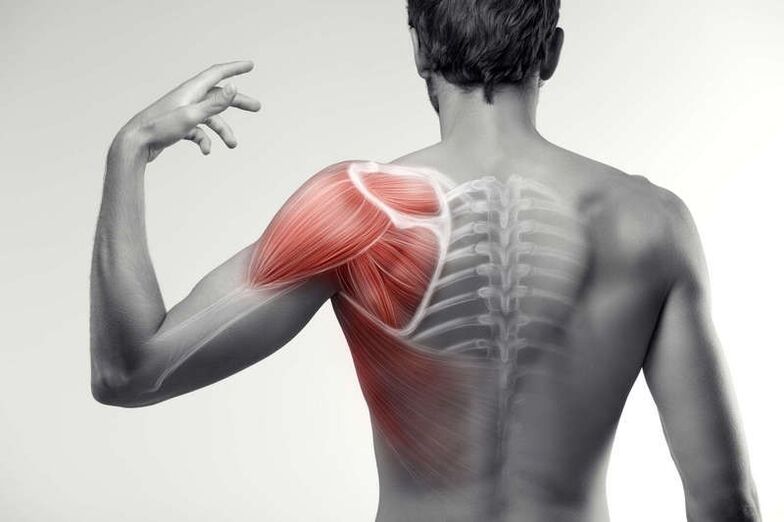 areas of muscle pain