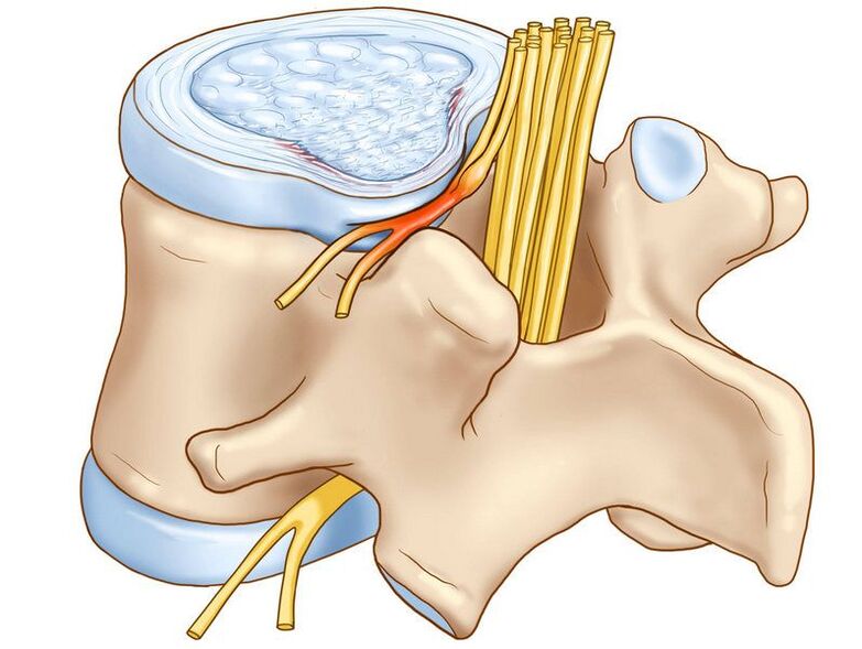 the spinal column is another cause of possible pain