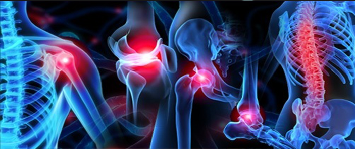 Joint lesions